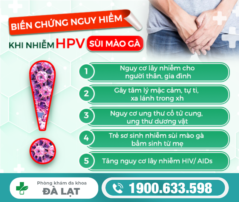 Hình ảnh minh họa